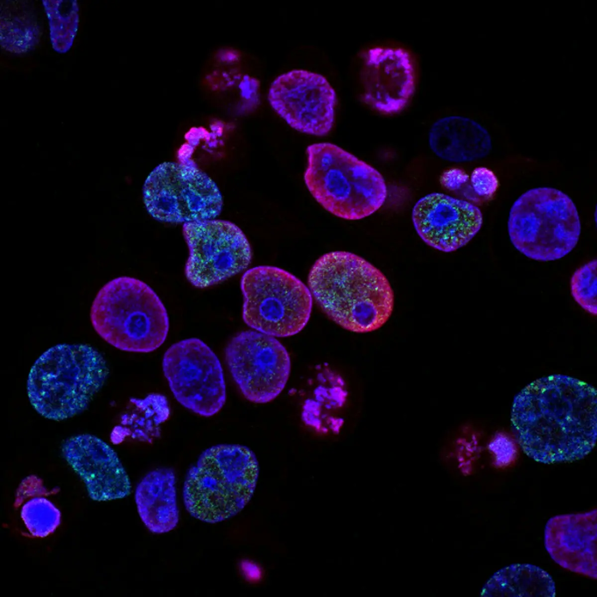 Rapamycin for Longevity: Human Evidence, Mouse Data & Risks